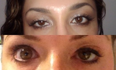 Botox - azaz, ahol, kinek és milyen ez szükséges, a fitness közösségi portál fitneszrajongó (Beauty) Botox - azaz, ahol, kinek és milyen ez szükséges, a fitness közösségi portál fitnesz szerelmesei,