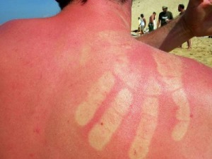 Îngrijorează pielea după soare ce să facă