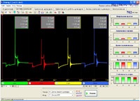 Diagnosticarea mașinilor din Orenburg, care este diagnosticul, diagnosticul cu un osciloscop,