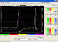 Diagnosticarea mașinilor din Orenburg, care este diagnosticul, diagnosticul cu un osciloscop,