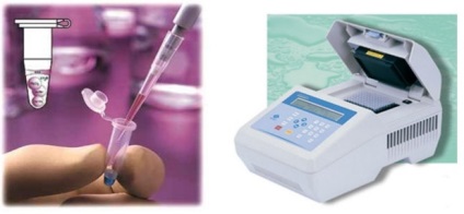 Diagnosticul leptospirozei folosind metoda PCR