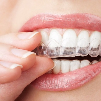 Cum să vă albiți dinții la domiciliu cu remedii folclorice și pastă de dinți