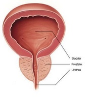 Calciul din glanda prostatică cauzează formarea, simptomele și tratamentul remediilor populare