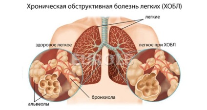 Tratarea remediilor folclorice la domiciliu