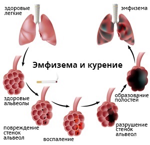 Tratarea remediilor folclorice la domiciliu