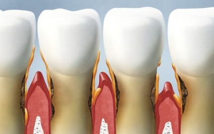 Tratamentul dinților în centrul stomatologic - o zână dentară