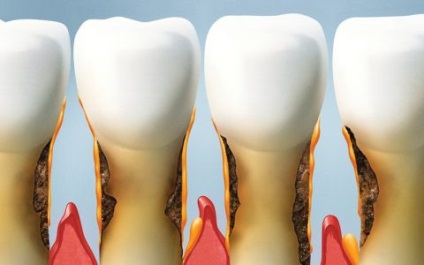 Tratamentul dinților în centrul stomatologic - o zână dentară