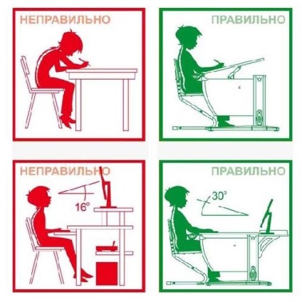 Încălcarea posturii - tipuri, cauze, tratament și prevenire