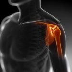 Hány napig így beteg osteochondrosis (adni) Hány napig adni beteg osteochondrosis