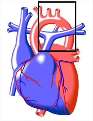 Neproliferarea canalului botulinic, diagnosticul și tratamentul în Israel