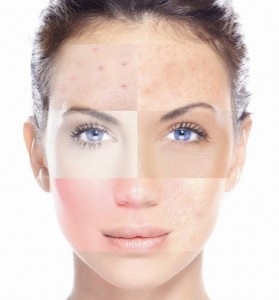 Determinarea tipului de piele a feței prin metode eficiente