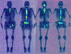 Diviziunea metodelor radiologice și combinate de tratare a bolilor ginecologice