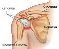 Periartroza - cauze, simptome, diagnostic și tratament