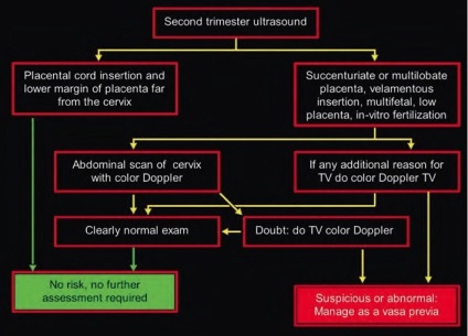 Prezentarea vestigală este o tragedie care poate fi prevenită