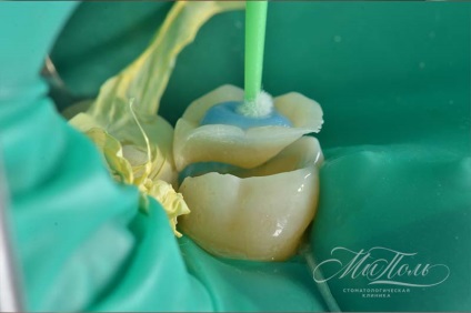 Protetica dentară în Kurkino, Khimki - prețuri, recenzii - ortopedie