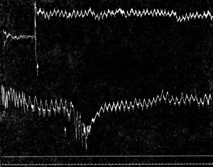 Tulburări ale circulației sângelui în tulburările de ton vascular 1965 alpern