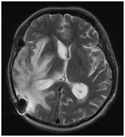 Regionális Diagnosztikai Központ - CT, MRI, CT, ultrahang