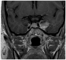 Regionális Diagnosztikai Központ - CT, MRI, CT, ultrahang