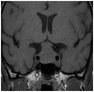 Regionális Diagnosztikai Központ - CT, MRI, CT, ultrahang