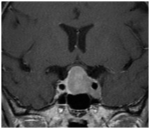 Regionális Diagnosztikai Központ - CT, MRI, CT, ultrahang