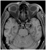 Centrul Regional de Diagnosticare - mrt, kt, tomografie, uzi