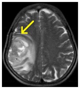 Regionális Diagnosztikai Központ - CT, MRI, CT, ultrahang