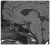 Regionális Diagnosztikai Központ - CT, MRI, CT, ultrahang