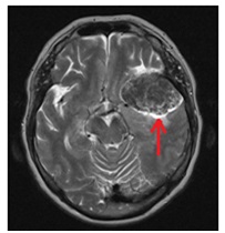 Regionális Diagnosztikai Központ - CT, MRI, CT, ultrahang