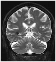 Regionális Diagnosztikai Központ - CT, MRI, CT, ultrahang