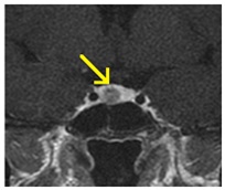 Centrul Regional de Diagnosticare - mrt, kt, tomografie, uzi