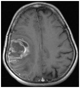 Regionális Diagnosztikai Központ - CT, MRI, CT, ultrahang