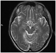 Centrul Regional de Diagnosticare - mrt, kt, tomografie, uzi