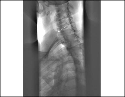 Radiografia indicației traheale, comportament, rezultate