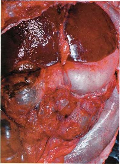 Insuficiența vasculară a intestinului a (k55)