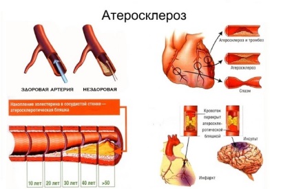 Fluierul în urechi și capul cauzei, tratamentul, lista de medicamente