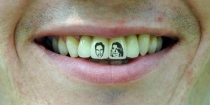 Tatuaje pe dinți