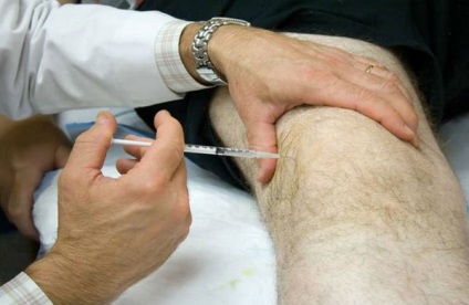 Injecții în articulația genunchiului cu medicamente artrozice și contraindicații