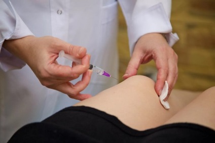 Injecții în articulația genunchiului cu medicamente artrozice și contraindicații