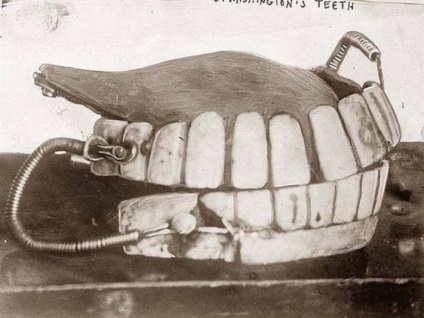 Ororile din stomatologia medievală, de la care veți înceta să vă temeți de medicul dentist - începutul