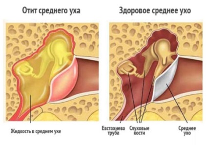 Zalozhennost o ureche cu o durere și fără ce să se angajeze și cum să se trateze