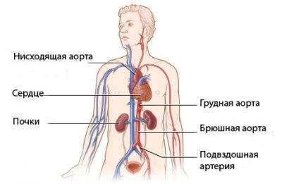 Érelmeszesedés Az aorta a szív milyen betegségben, tünetei és kezelése