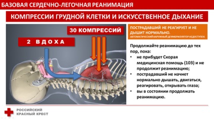 Resuscitarea cardiopulmonară de bază