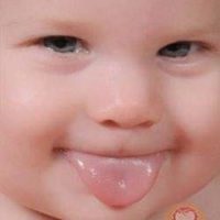 Acoperire albă pe limba copilului - cauze și tratament