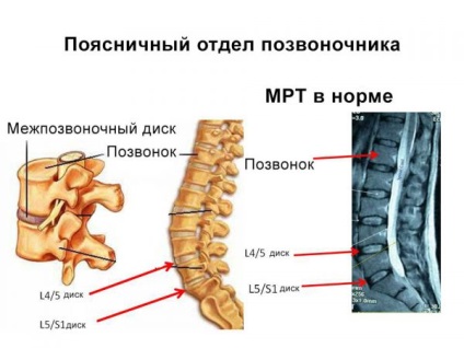 Ce arată mrtul coloanei vertebrale lombosacrale