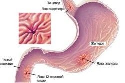 Ce sunt bacteriile vii și ce efect au asupra corpului de tratament la domiciliu