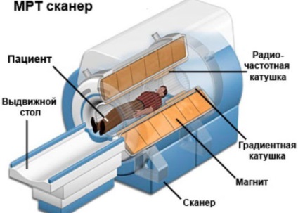 Amennyiben az MRI (mágneses rezonancia) az agy számítógépes diagnosztika