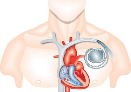 Unde se face mrt (imagistica prin rezonanță magnetică) a diagnosticării computerizate a creierului