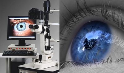 Glaucomul păstrează vederea