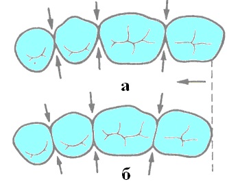 3. fejezet az ív fogászati (fogra) 3. fejezet fogsorívéhez