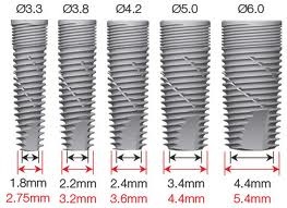 Implantarea cortexului implantat al dinților, implanturile dentare (implanturi)